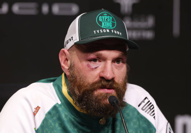 Tyson Fury